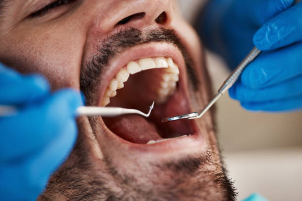 Best Emergency Treatment for Jaw Pain or Injury in Columbia, TN