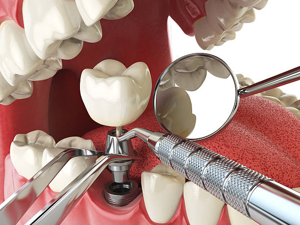 Best Emergency Denture Repair in Columbia, TN